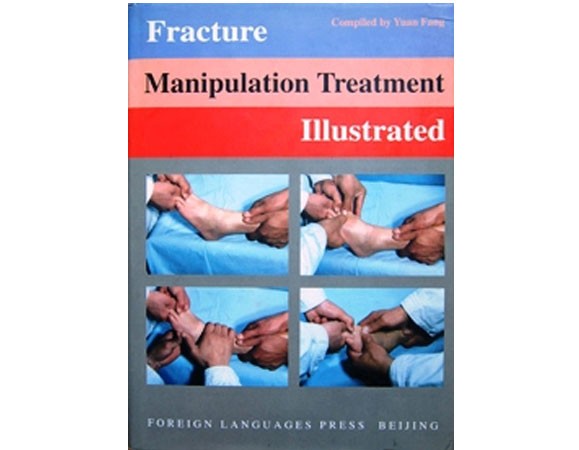 Fracture Manipulation Treatment Illustrated